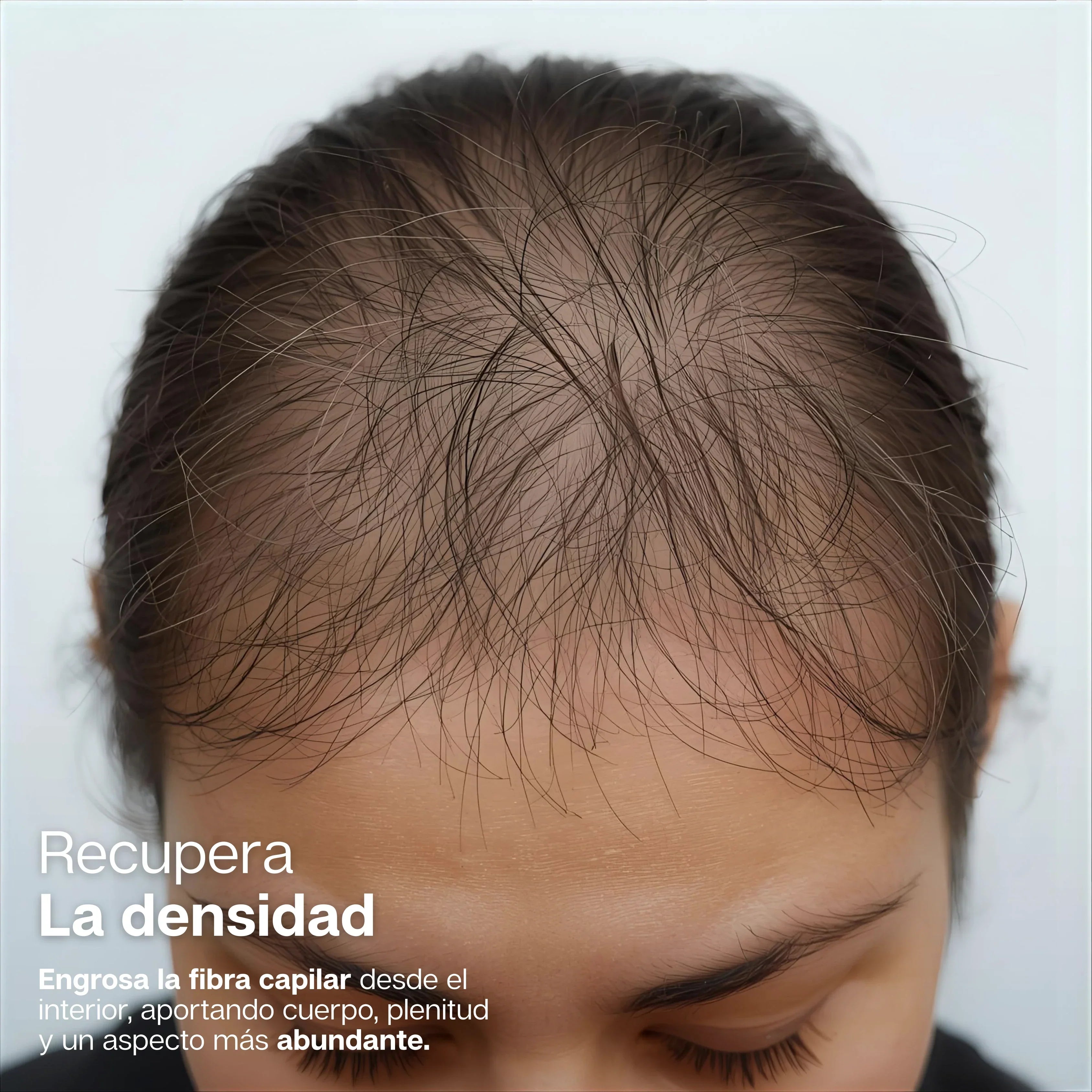 🌿 Tratamiento Anticaída OUHOE + ENVÍO GRATIS